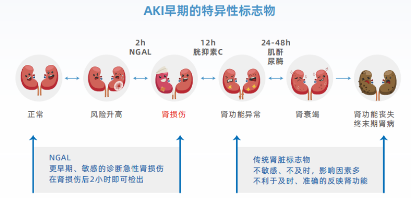 NGAL：中文名記不住，要記住這些臨床價(jià)值