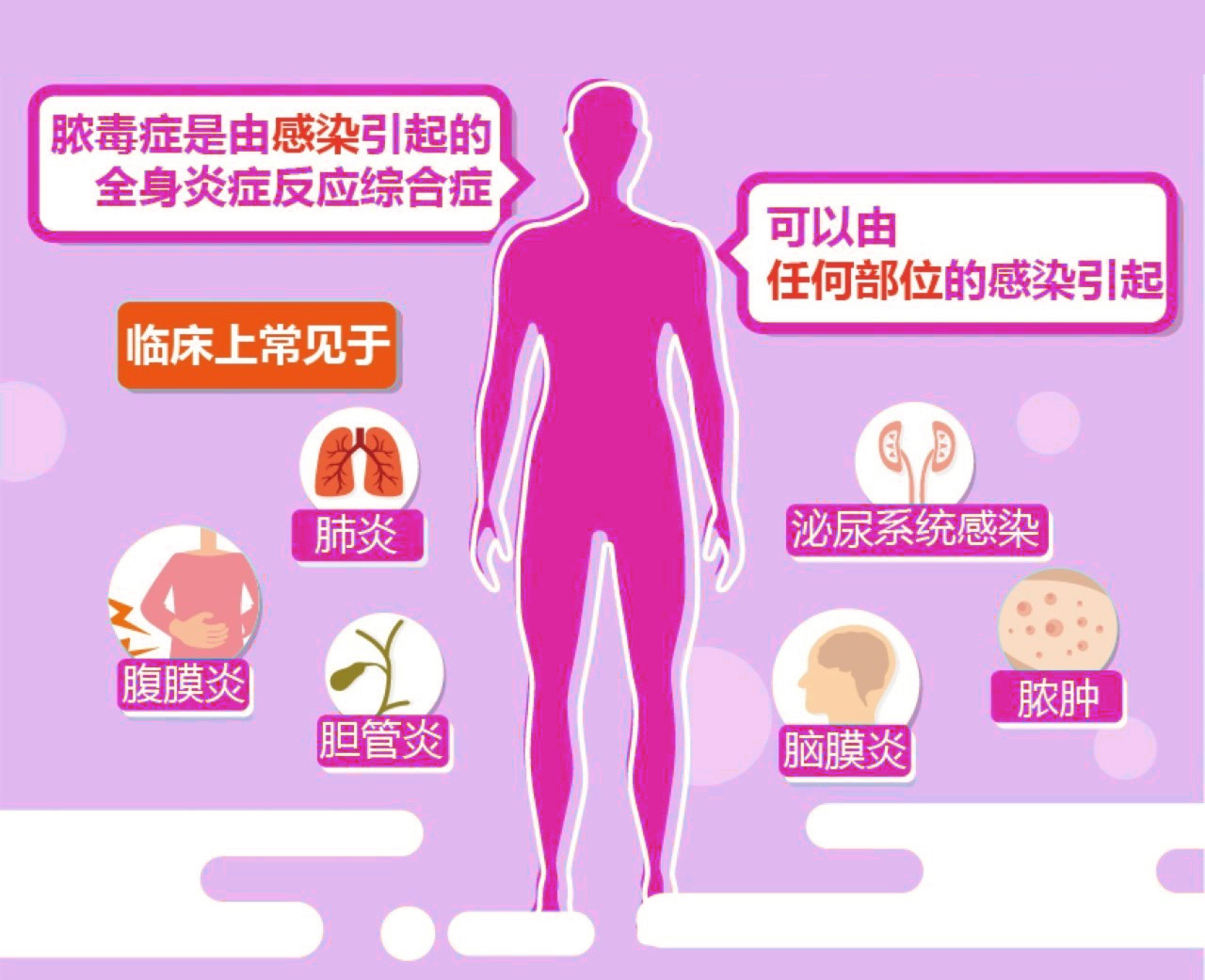 世界膿毒癥日|國(guó)賽生物PCT-IL-6聯(lián)合檢測(cè)多種解決方案